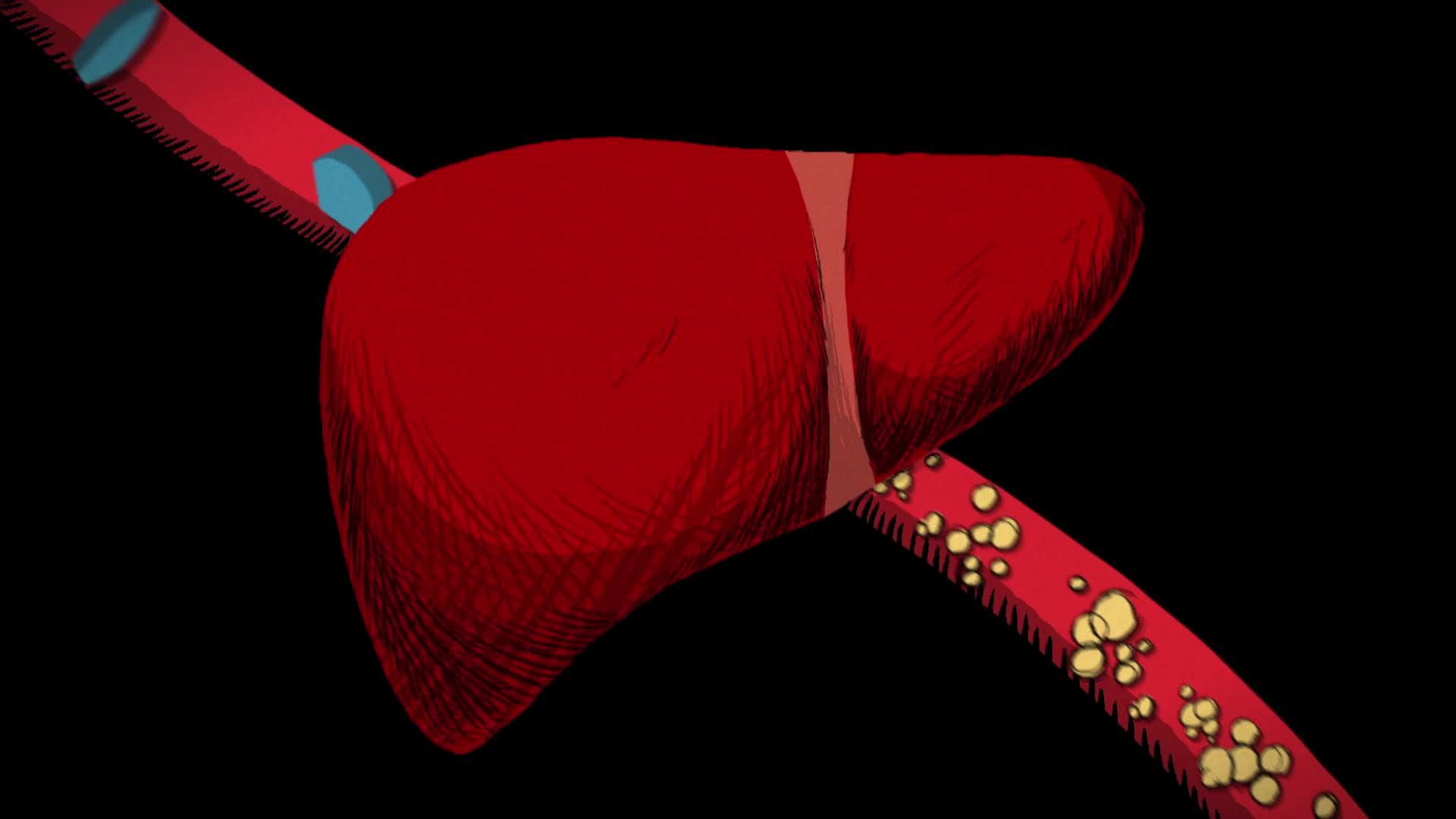 The Cholesterol Question